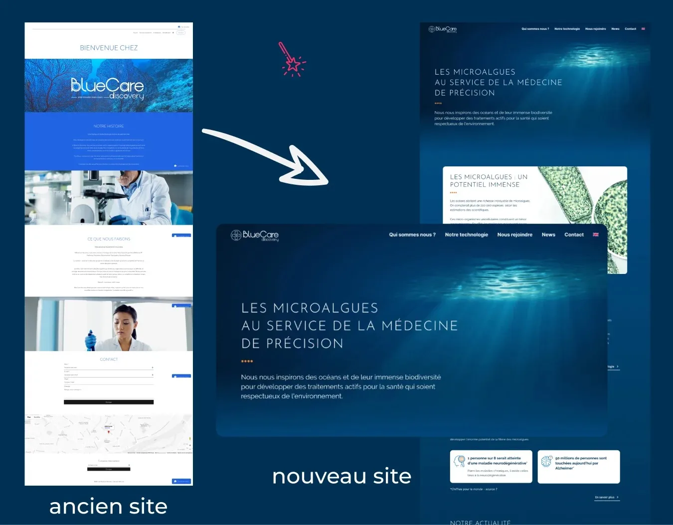 Avant / après sitre BlueCare Discovery